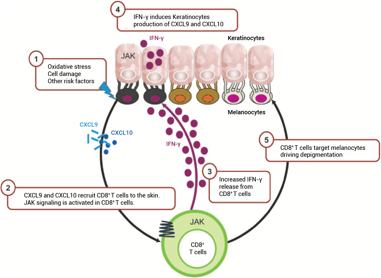 Inflammation